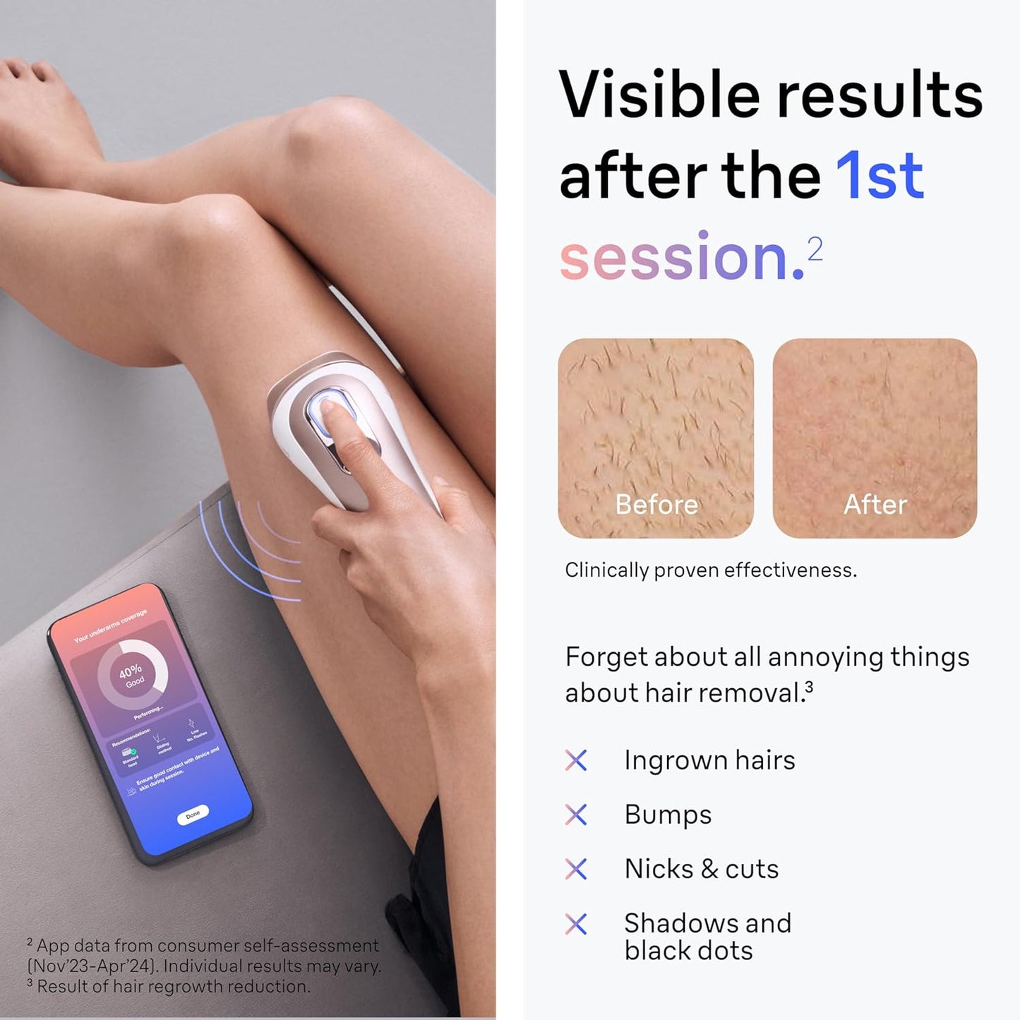 Braun IPL Skin I·Expert, at Home Laser Hair Removal, Holiday Gifts for Women and Men with Free App, Vanity Case, Venus Razor, 4 Smart Heads, PL7387