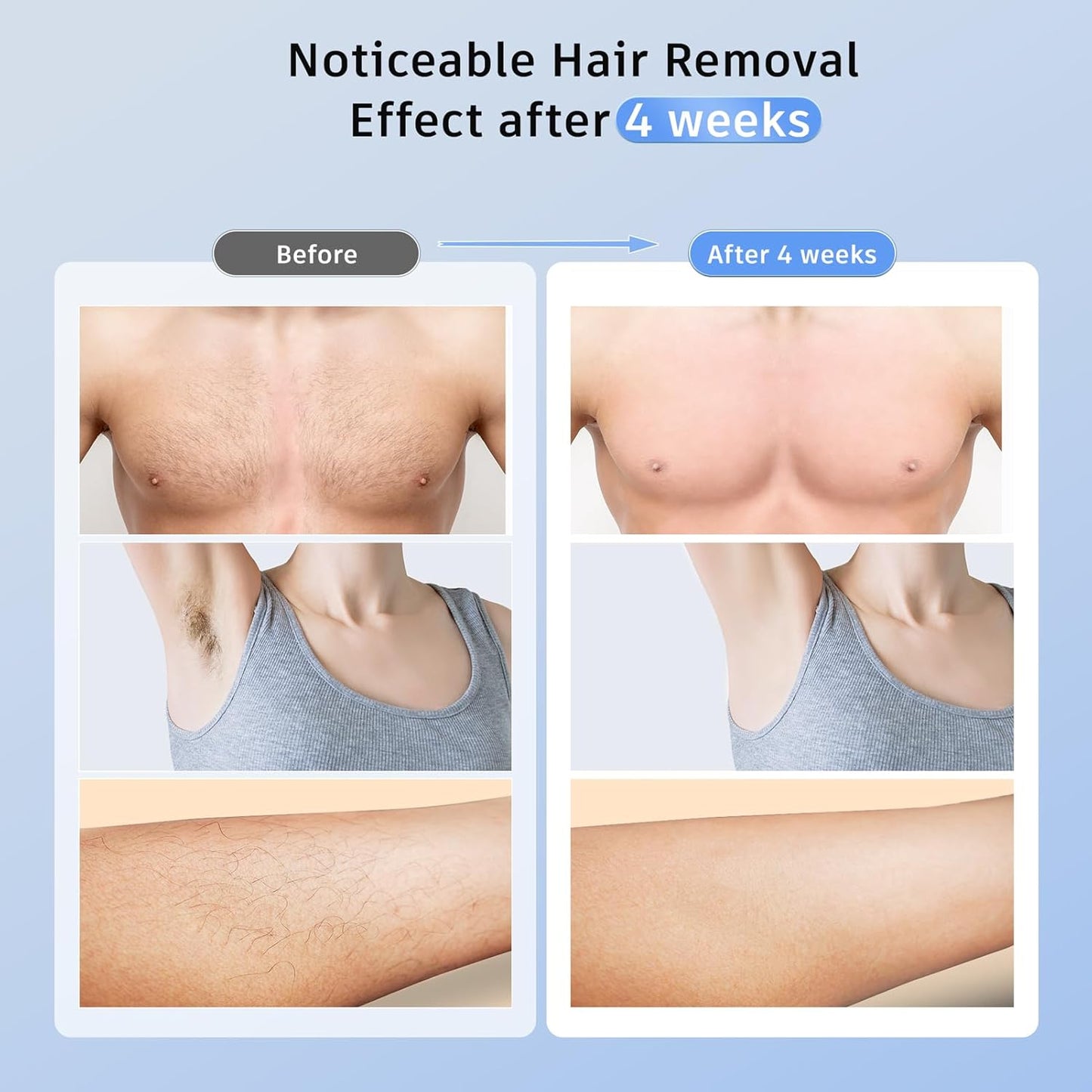 Laser Hair Removal with 5℃ Ice Cooling, Painless IPL Laser Hair Removal Device 3 in 1 Ubroo at Home Hair Remover Machine for Women Men Electrolysis Permanent Epilator on Face Body Depilation (Gold)