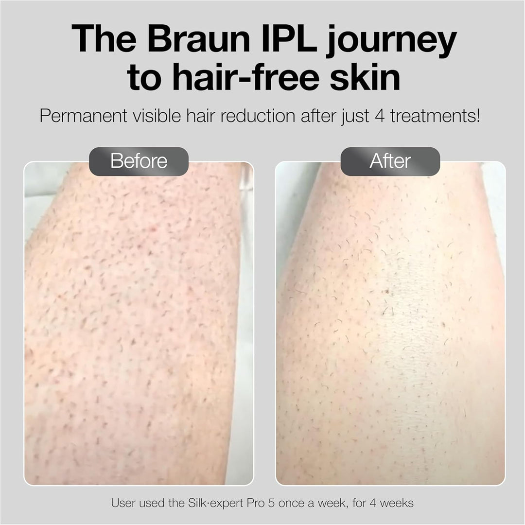 Braun IPL Long-Lasting Hair Removal System for Women and Men, Silk Expert Pro 3 PL3221, Head-To-Toe Usage, for Body & Face, Alternative to Salon Laser Hair Removal, with 3 Caps