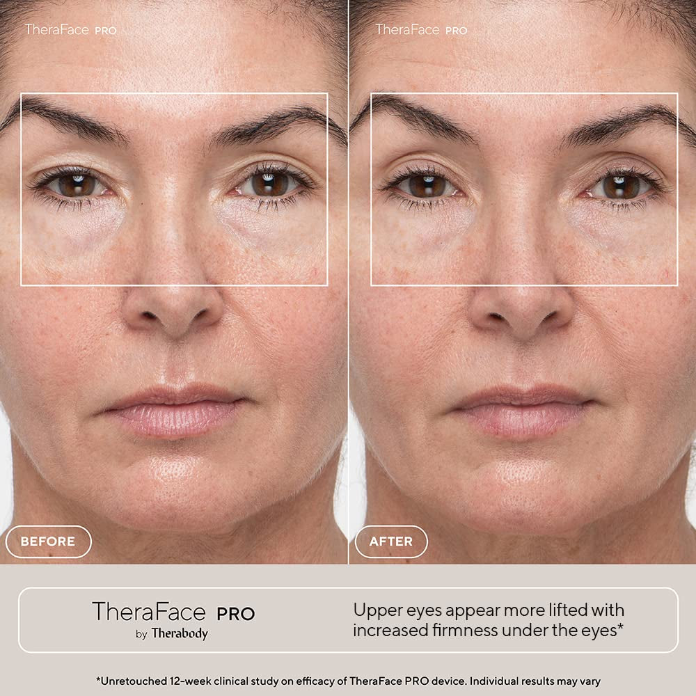 PRO Microcurrent Facial Device - 8-In-1 Compact Face Massager, Facial Kit & Face Sculpting Tool with Light Therapy for Skin Tightening, anti Wrinkle, anti Aging & Skin Care (White)