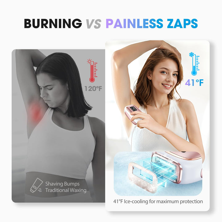 Oreeth Ice45 Depiladora IPL RoseGold