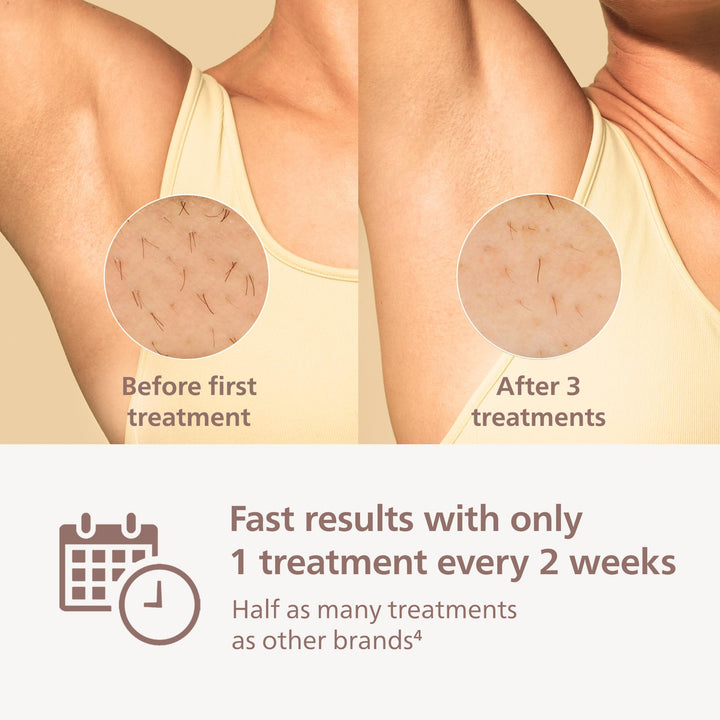 Philips BRI98403 Depiladora IPL Lumea9000