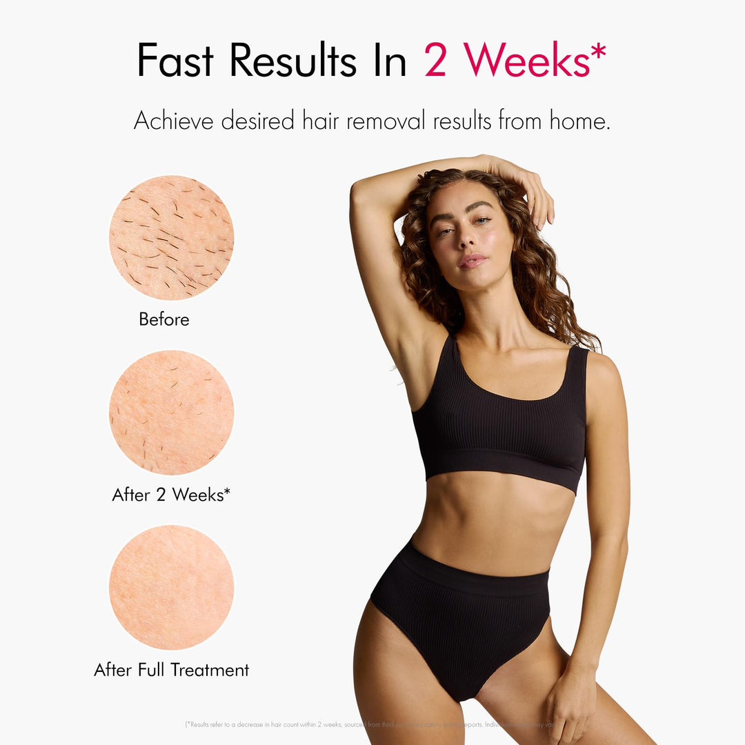 Ulike Air10 Depiladora IPL UI20RE