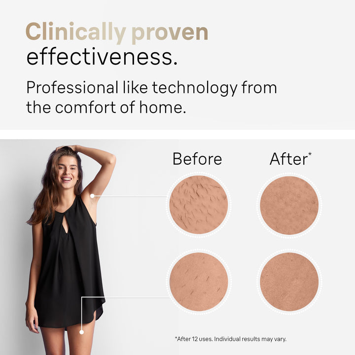 Braun PL5137 Depiladora IPL Pro5