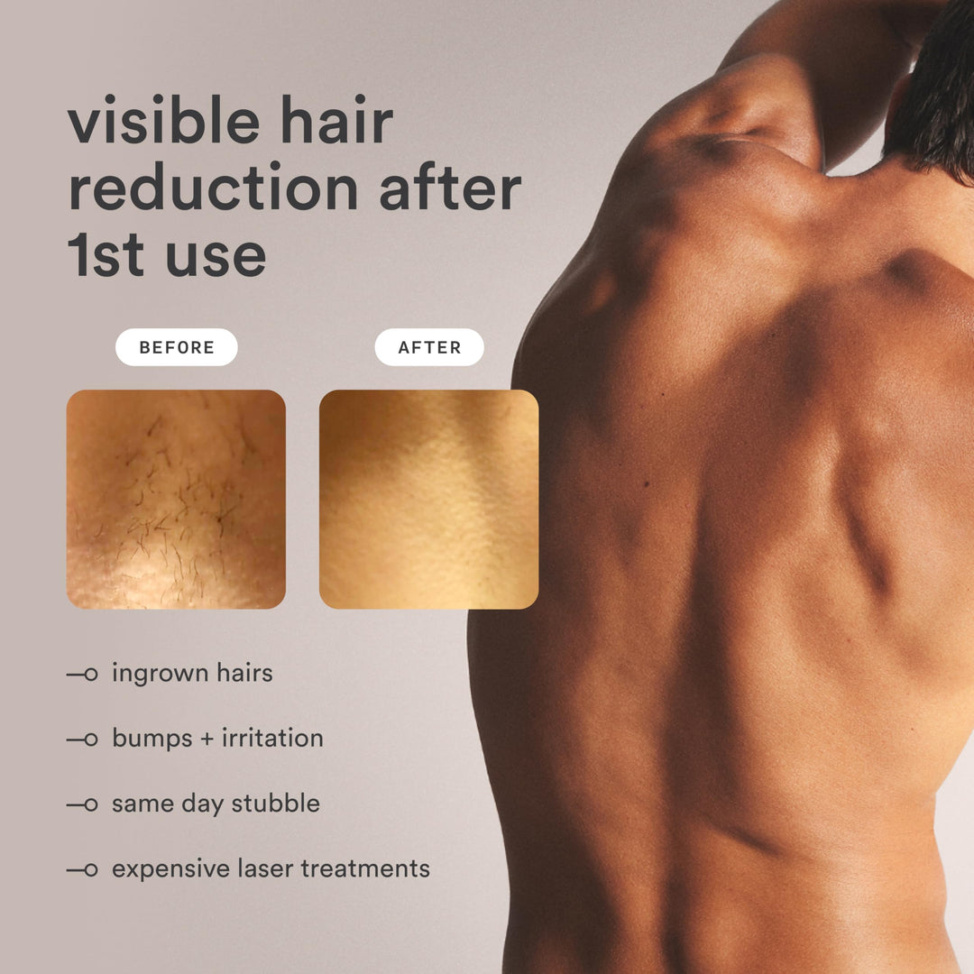 Nood Flasher Pro Depiladora IPL GlossWhite