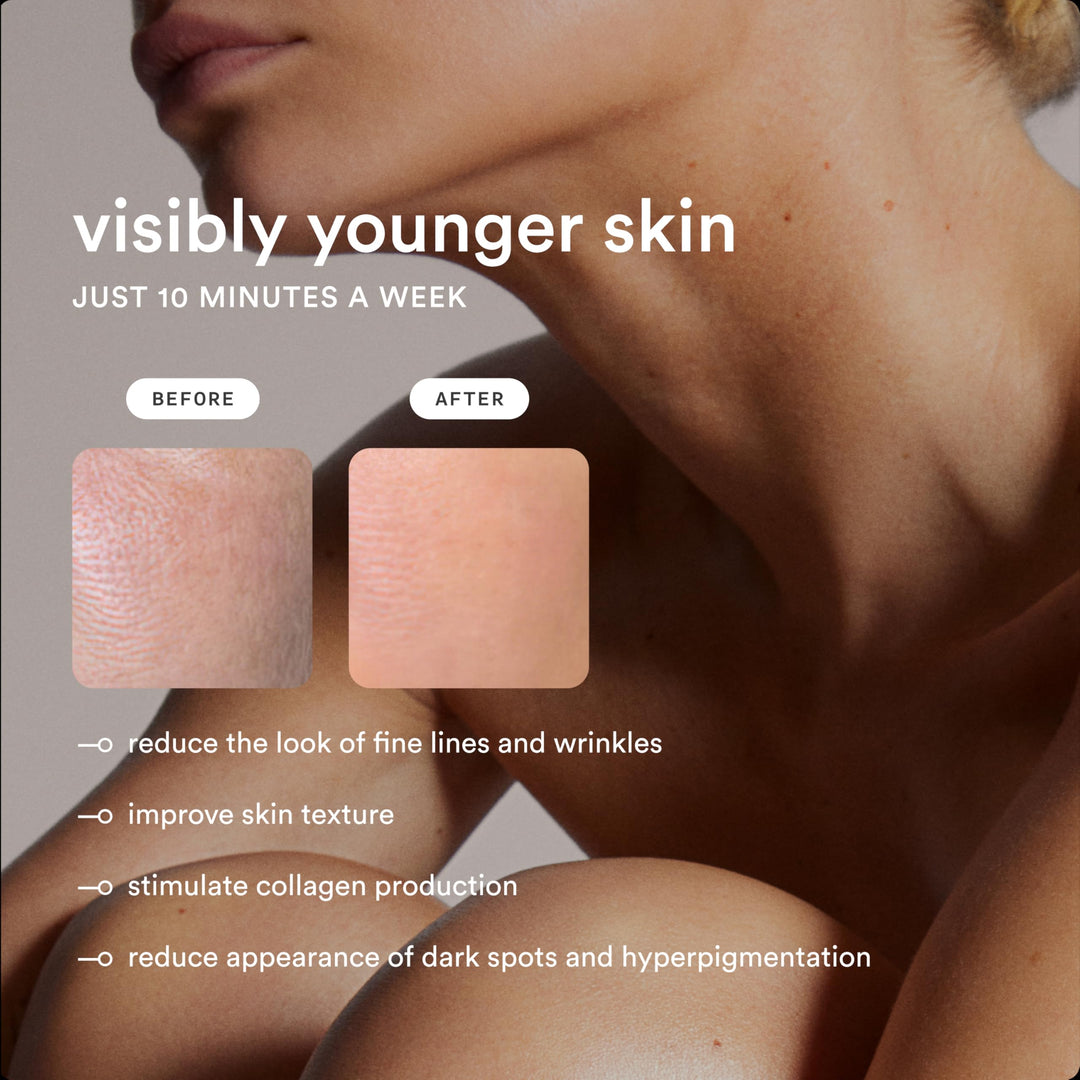 Nood Flasher Pro Depiladora IPL GlossWhite